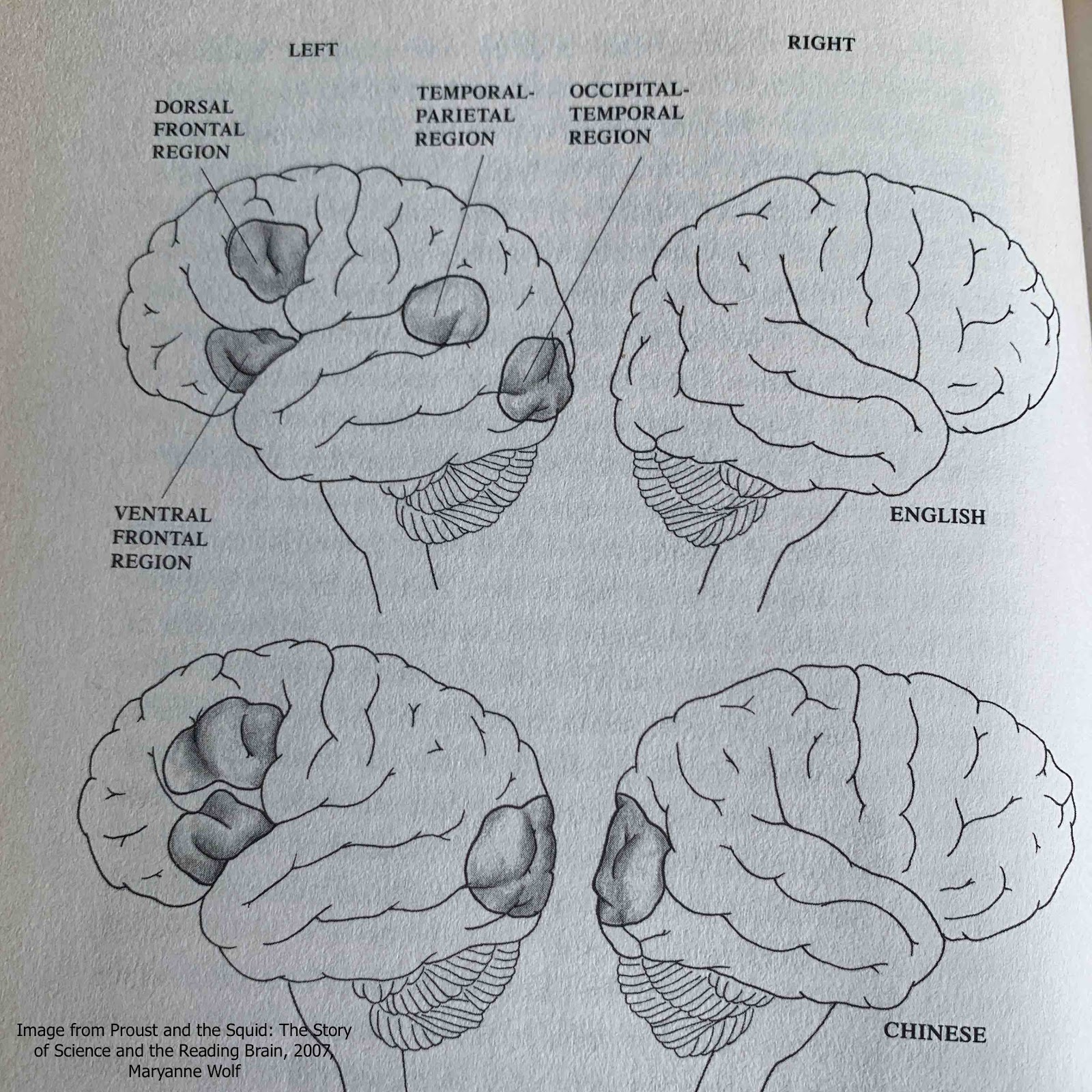 how children learn to read - the brain lit up